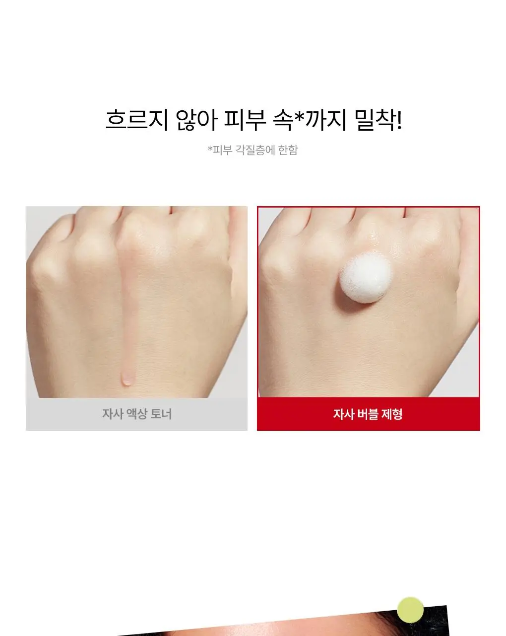 [NEW/단독기획] rdrd 레드 애플 락토 진정 팝핑 토너 95g 응급진정 KIT 기획 상세페이지 29